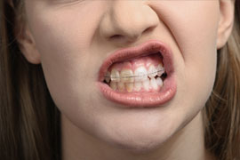 girl with braces